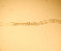 Nematoden bekämpfen So wird man Fadenwürmer im Garten los