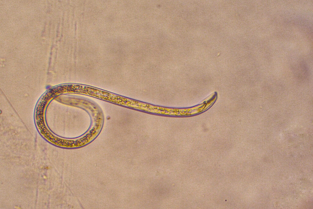 vergrößerte Nematoden